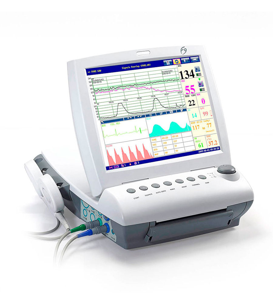 Importadora y Distribuidora Monar - Monitor De Frecuencia Cardíaca